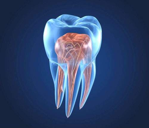 Kanal Tedavisi Endodonti